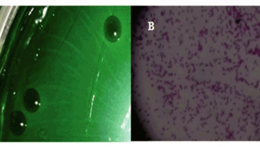 Giải pháp kiểm soát bệnh do vi khuẩn Vibrio
